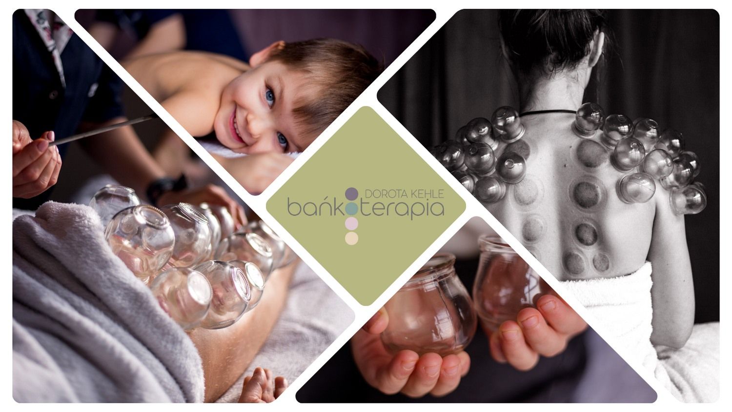 Sesja bańkoterapii — bańki ogniowe stosowane na plecach klientki